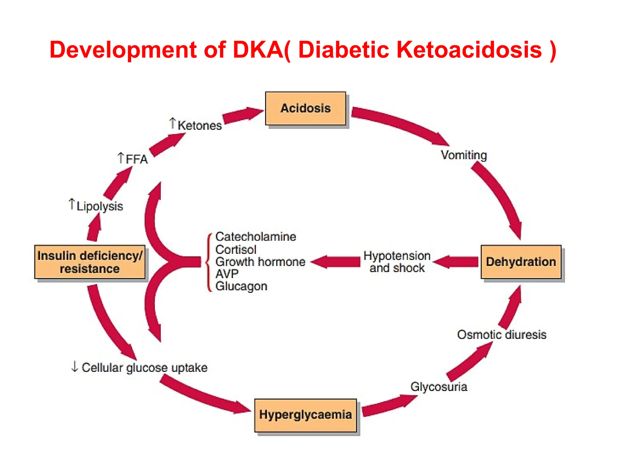 Development of DKA( Diabetic Ketoacidosis )
 