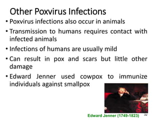 32
Other Poxvirus Infections
• Poxvirus infections also occur in animals
• Transmission to humans requires contact with
infected animals
• Infections of humans are usually mild
• Can result in pox and scars but little other
damage
• Edward Jenner used cowpox to immunize
individuals against smallpox
Edward Jenner (1749-1823)
 