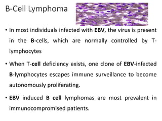 B-Cell Lymphoma
• In most individuals infected with EBV, the virus is present
in the B-cells, which are normally controlled by T-
lymphocytes
• When T-cell deficiency exists, one clone of EBV-infected
B-lymphocytes escapes immune surveillance to become
autonomously proliferating.
• EBV induced B cell lymphomas are most prevalent in
immunocompromised patients.
 