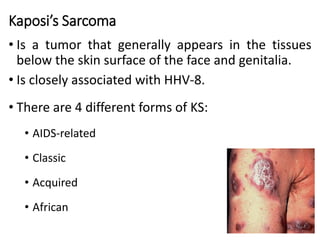 Kaposi’s Sarcoma
• Is a tumor that generally appears in the tissues
below the skin surface of the face and genitalia.
• Is closely associated with HHV-8.
• There are 4 different forms of KS:
• AIDS-related
• Classic
• Acquired
• African
 