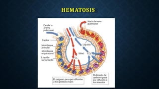 HEMATOSIS
 