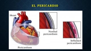 EL PERICARDIO
 