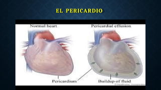 EL PERICARDIO
 