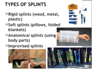 first aid management of injuries and fracture | PPTX