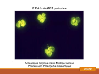 insuficiencia renal aguda tomaría para repasar.pptx