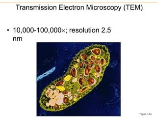 • 10,000-100,000; resolution 2.5
nm
Transmission Electron Microscopy (TEM)
Figure 3.8a
 