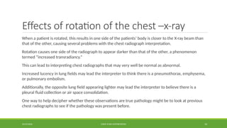 3. CHEST X-RAY INTERPRETATIOn for medical students.pptx