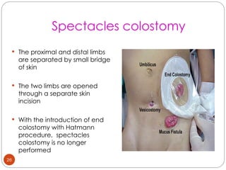 Comprehensive Guide to Colostomy: Indications, Types, Care, and Closure ...