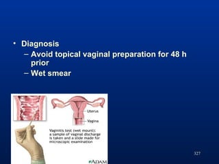 327
• Diagnosis
– Avoid topical vaginal preparation for 48 h
prior
– Wet smear
 