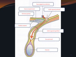 Vasos epigástricos inferioresFascia extraperitonealAnillo inguinal profundoPeritoneo parietalTendón conjuntoAnillo inguinal superficialSaco peritonealTestículo 21