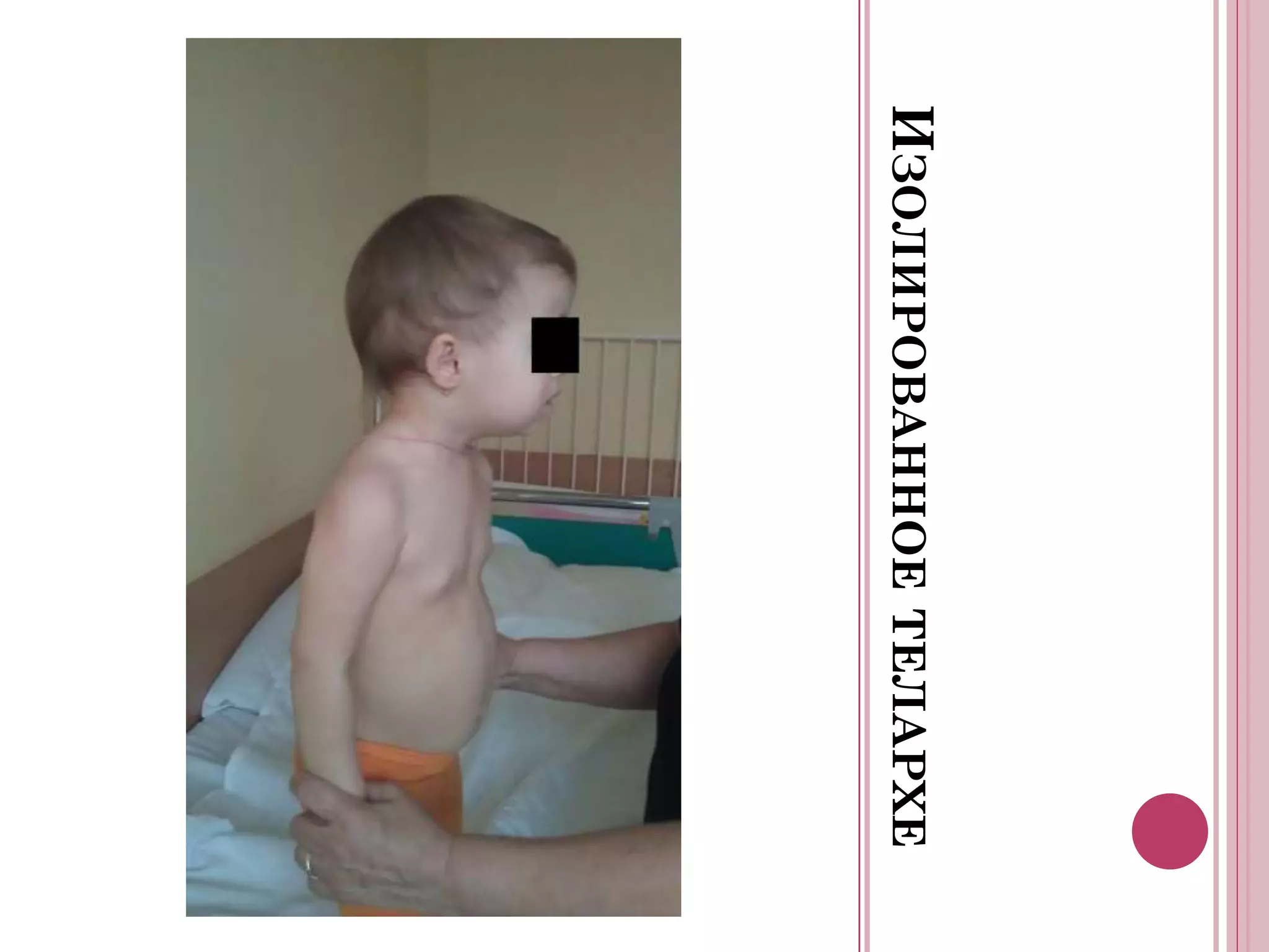 ИЗОЛИРОВАННОЕ ТЕЛАРХЕ
 