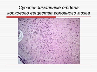 Субэпендимальные отдела
коркового вещества головного мозга
 