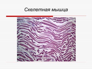 Скелетная мышца
 