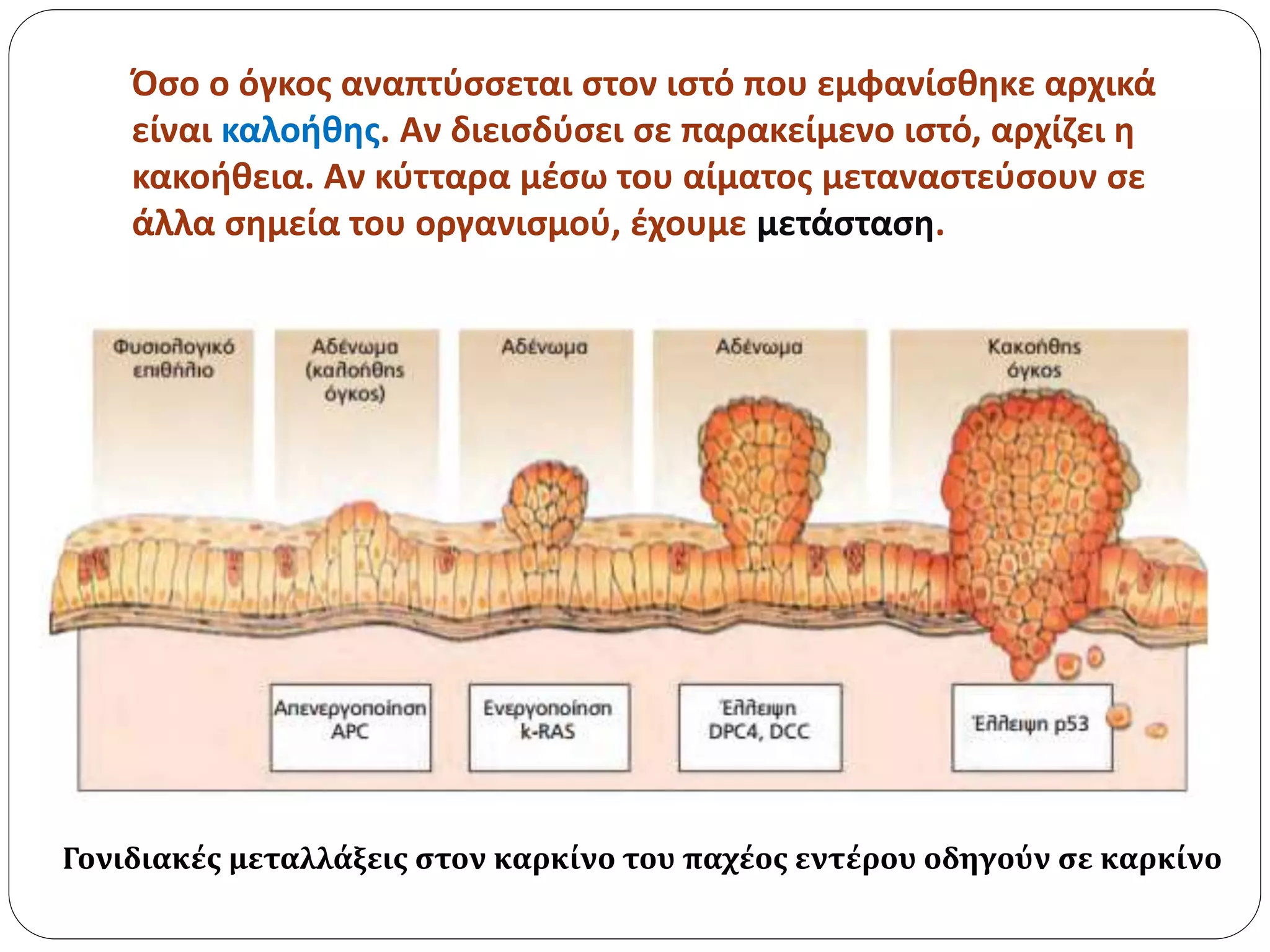 Όσο ο όγκος αναπτύσσεται στον ιστό που εμφανίσθηκε αρχικά
είναι καλοήθης. Αν διεισδύσει σε παρακείμενο ιστό, αρχίζει η
κακοήθεια. Αν κύτταρα μέσω του αίματος μεταναστεύσουν σε
άλλα σημεία του οργανισμού, έχουμε μετάσταση.
Γονιδιακές μεταλλάξεις στον καρκίνο του παχέος εντέρου οδηγούν σε καρκίνο
 