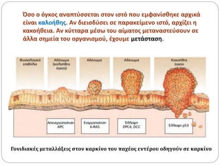 Όσο ο όγκος αναπτύσσεται στον ιστό που εμφανίσθηκε αρχικά
είναι καλοήθης. Αν διεισδύσει σε παρακείμενο ιστό, αρχίζει η
κακοήθεια. Αν κύτταρα μέσω του αίματος μεταναστεύσουν σε
άλλα σημεία του οργανισμού, έχουμε μετάσταση.
Γονιδιακές μεταλλάξεις στον καρκίνο του παχέος εντέρου οδηγούν σε καρκίνο
 