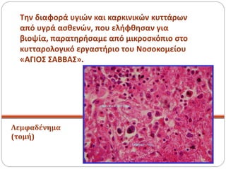 Την διαφορά υγιών και καρκινικών κυττάρων
από υγρά ασθενών, που ελήφθησαν για
βιοψία, παρατηρήσαμε από μικροσκόπιο στο
κυτταρολογικό εργαστήριο του Νοσοκομείου
«ΑΓΙΟΣ ΣΑΒΒΑΣ».
Λεμφαδένημα
(τομή)
 