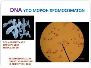 DNA ΥΠΟ ΜΟΡΦΗ ΧΡΩΜΟΣΩΜΑΤΩΝ
ΧΡΩΜΟΣΩΜΑΤΑ ΑΠΟ
ΗΛΕΚΤΡΟΝΙΚΟ
ΜΙΚΡΟΣΚΟΠΙΟ
ΧΡΩΜΟΣΩΜΑΤΑ ΑΠΟ
ΟΠΤΙΚΟ ΜΙΚΡΟΣΚΟΠΙΟ
ΣΕ ΜΕΓΕΘΥΝΣΗ 400Χ
 