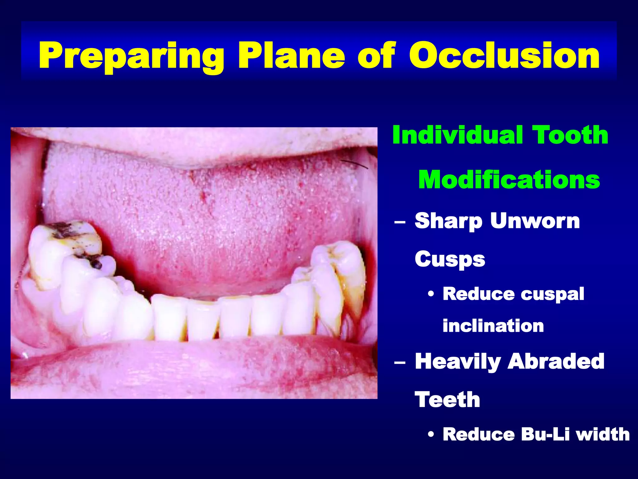 3 a. management of maxillary and mandibular single complete dentures | PPT