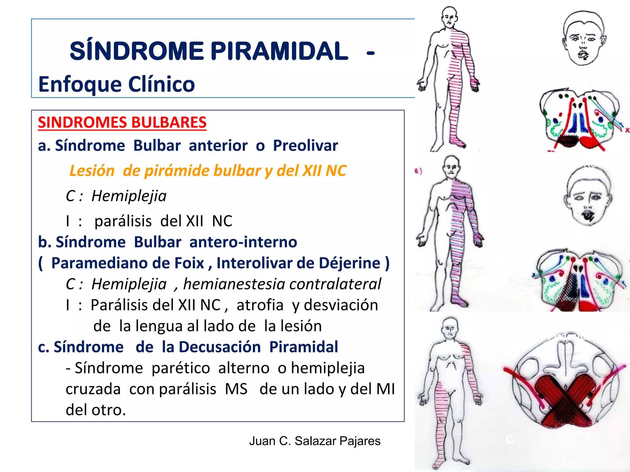 SINDROMES NEUROLÓGICOS - I Sd. PIRAMIDAL - NEURONA MOTORA SUPERIOR | PDF