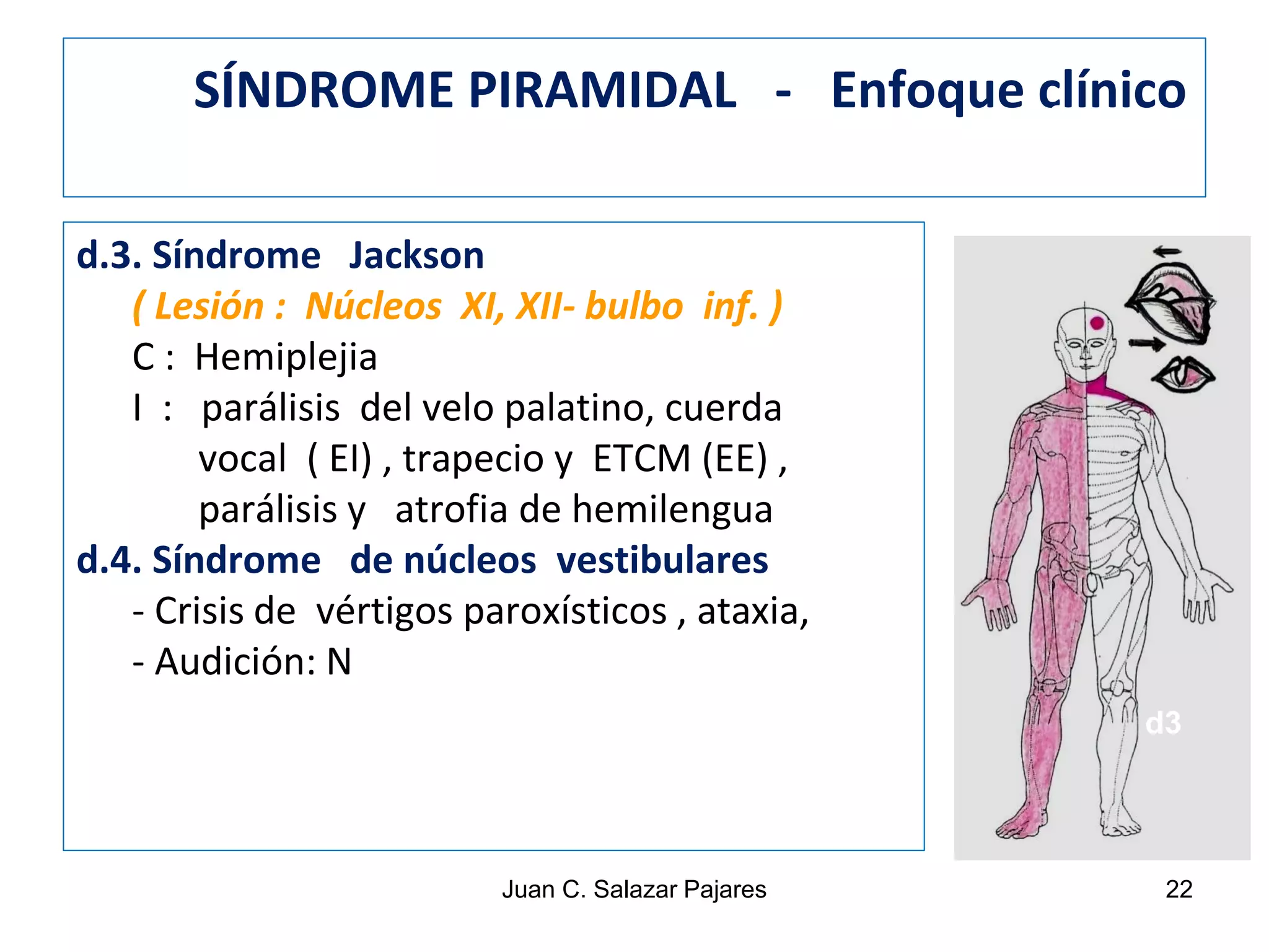 SINDROMES NEUROLÓGICOS - I Sd. PIRAMIDAL - NEURONA MOTORA SUPERIOR | PDF