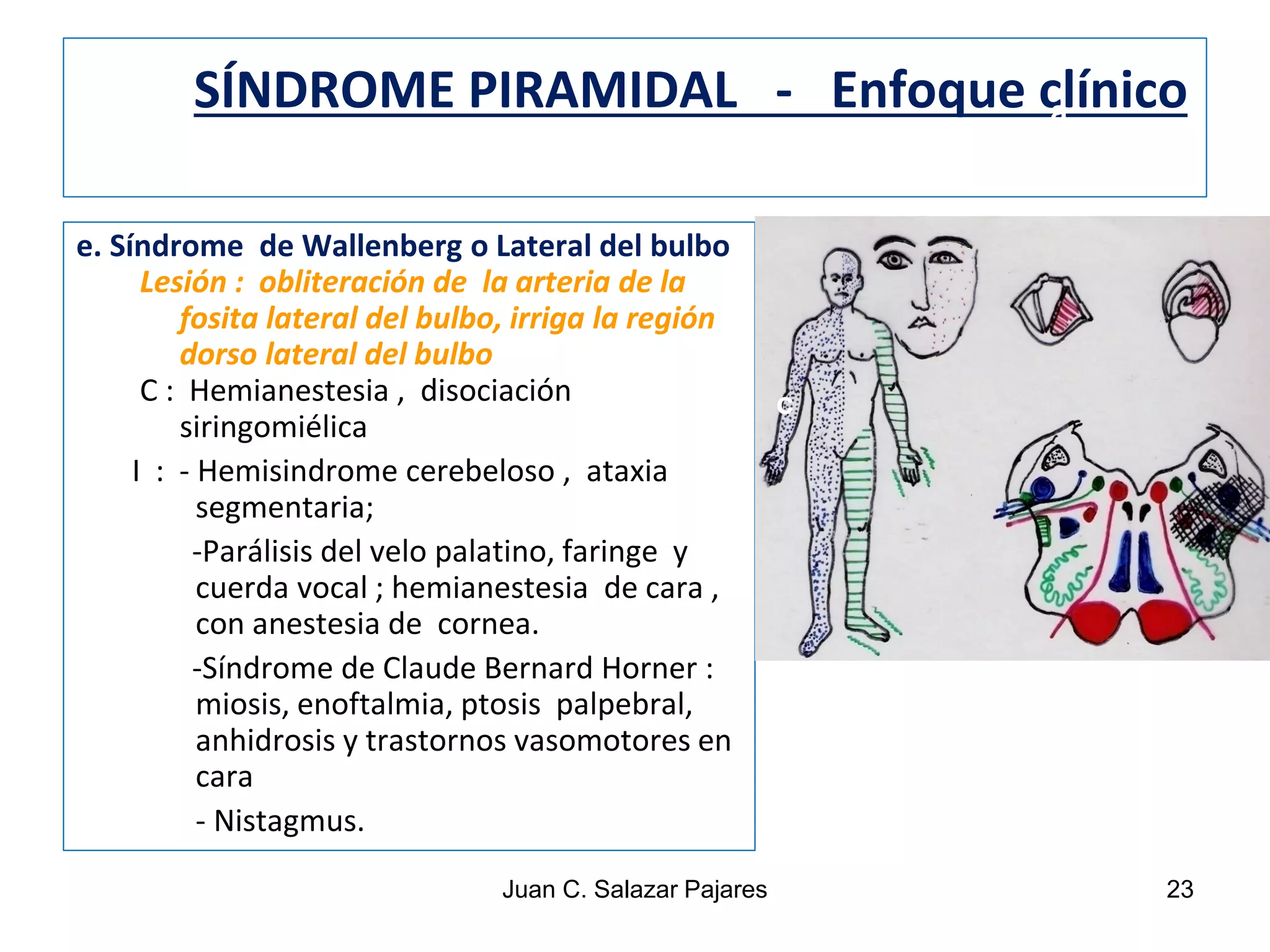 SINDROMES NEUROLÓGICOS - I Sd. PIRAMIDAL - NEURONA MOTORA SUPERIOR | PDF