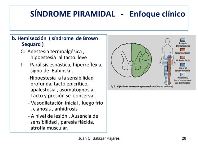 SINDROMES NEUROLÓGICOS - I Sd. PIRAMIDAL - NEURONA MOTORA SUPERIOR | PDF