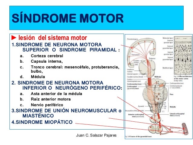 SINDROMES NEUROLÓGICOS - I Sd. PIRAMIDAL - NEURONA MOTORA SUPERIOR