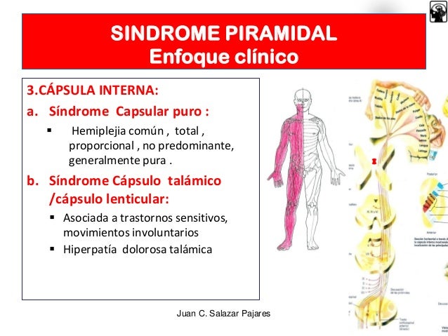 Sindrome Piramidal Neurologia | Syndrome Pyramidal Définition Simple – NRTC