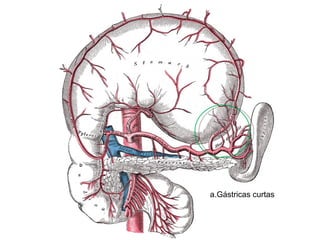 a.Gástricas curtas 