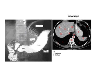estomago 