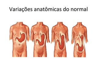 Variações anatômicas do normal 