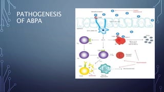 PATHOGENESIS
OF ABPA
 