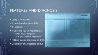 FEATURES AND DIAGNOSIS
• Long h/o asthma
•  peripheral eosinophils
•  total IgE
•  specific IgE to Aspergillus
• RAST IgE Aspergillus
• Skin prick test to Aspergillus
• Flitting consolidations on CXR
• Central bronchiectasis on CT
 