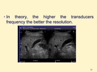 Comprehensive Overview of Acoustic Variables and Ultrasound Physics in ...