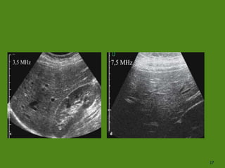 Comprehensive Overview of Acoustic Variables and Ultrasound Physics in ...