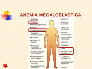 ANEMIA MEGALOBLÁSTICA
 