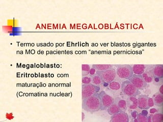 ANEMIA MEGALOBLÁSTICA
• Termo usado por Ehrlich ao ver blastos gigantes
na MO de pacientes com “anemia perniciosa”
• Megaloblasto:
Eritroblasto com
maturação anormal
(Cromatina nuclear)
 