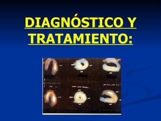 DIAGNÓSTICO Y TRATAMIENTO: 