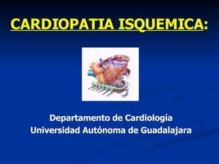 CARDIOPATIA ISQUEMICA : Departamento de Cardiología Universidad Autónoma de Guadalajara 