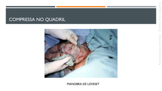 COMPRESSA NO QUADRIL
MANOBRA DE LOVESET
Apresentaçõesanômalas–CarolineReisGonçalves
 