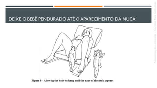 DEIXE O BEBÊ PENDURADO ATÉ O APARECIMENTO DA NUCA
Apresentaçõesanômalas–CarolineReisGonçalves
 