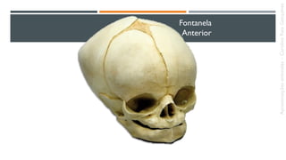 Fontanela
Anterior
Apresentaçõesanômalas–CarolineReisGonçalves
 