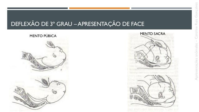 Apresentação De Face