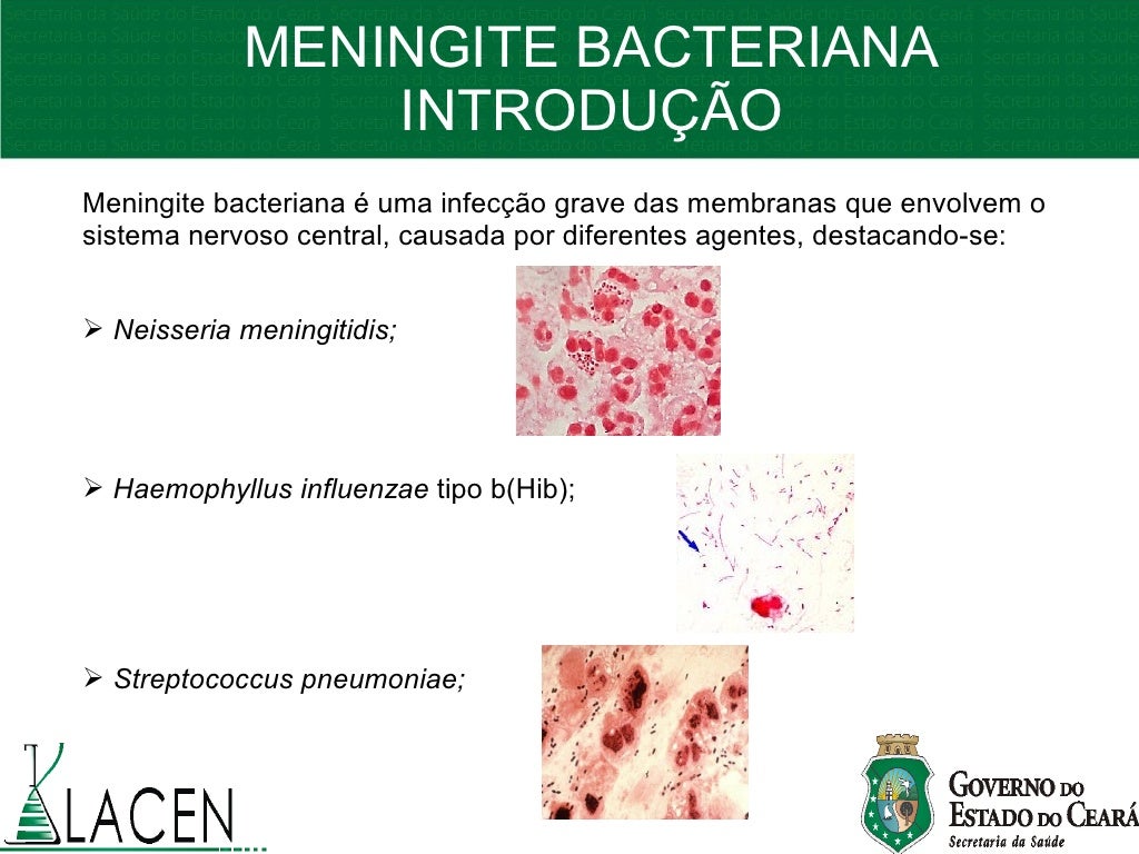 3. apresenta+ç+âo meningite bacteriana iracema2009 3. apresenta+ç+âo meningite bacteriana iracema2009