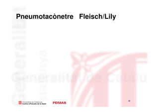 Pneumotacònetre Fleisch/Lily




                               15
                                    15
 