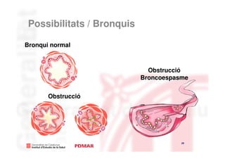 Possibilitats / Bronquis

Bronqui normal



                              Obstrucció
                            Broncoespasme


       Obstrucció




                                       29
                                            29
 