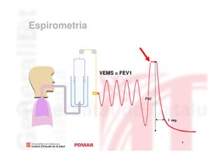 Espirometria



               VEMS = FEV1




                             FVC




                                   1 seg.




                                            3
                                                3
 