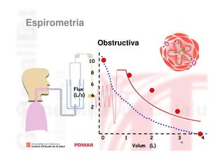 Espirometria

                      Obstructiva

                 10

                 8

                 6
         Flux
         (L/s)   4

                 2




                       0     1         2     3    4
                                             31
                                 Volum (L)
 