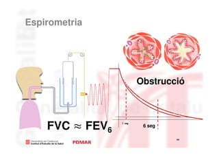 Espirometria




                         Obstrucció



    FVC ≈ FEV6   1 seg
                          6 seg

                                  44
                                       44
 