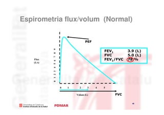 Espirometria flux/volum (Normal)


                                    PEF


            7 8 9
                                              FEV1       3.9 (L)
                                              FVC        5.0 (L)
    Flux                                      FEV1/FVC   78 %
            4 5 6


    (L/s)
            0 1 2 3




                      0   1     2     3   4   5

                              Volum (L)           FVC

                                                           45
                                                                   45
 